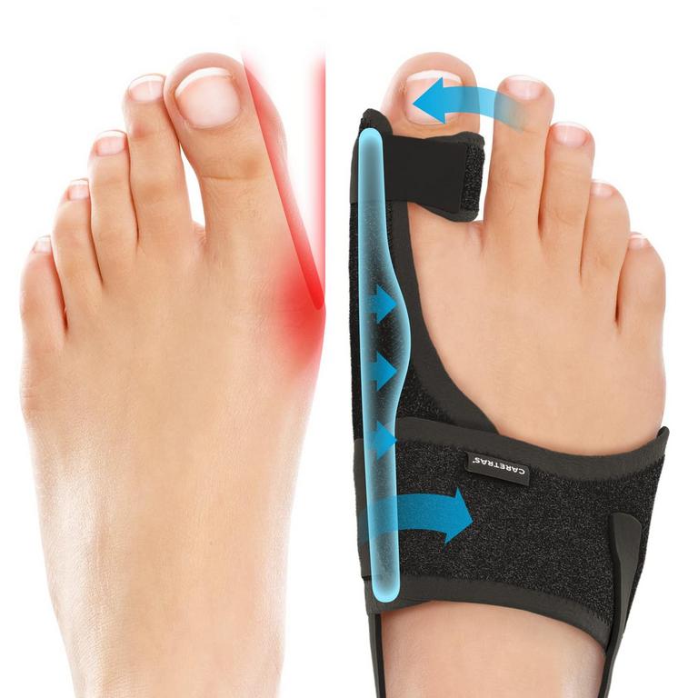 CARETRAS BUNION CORRECTOR